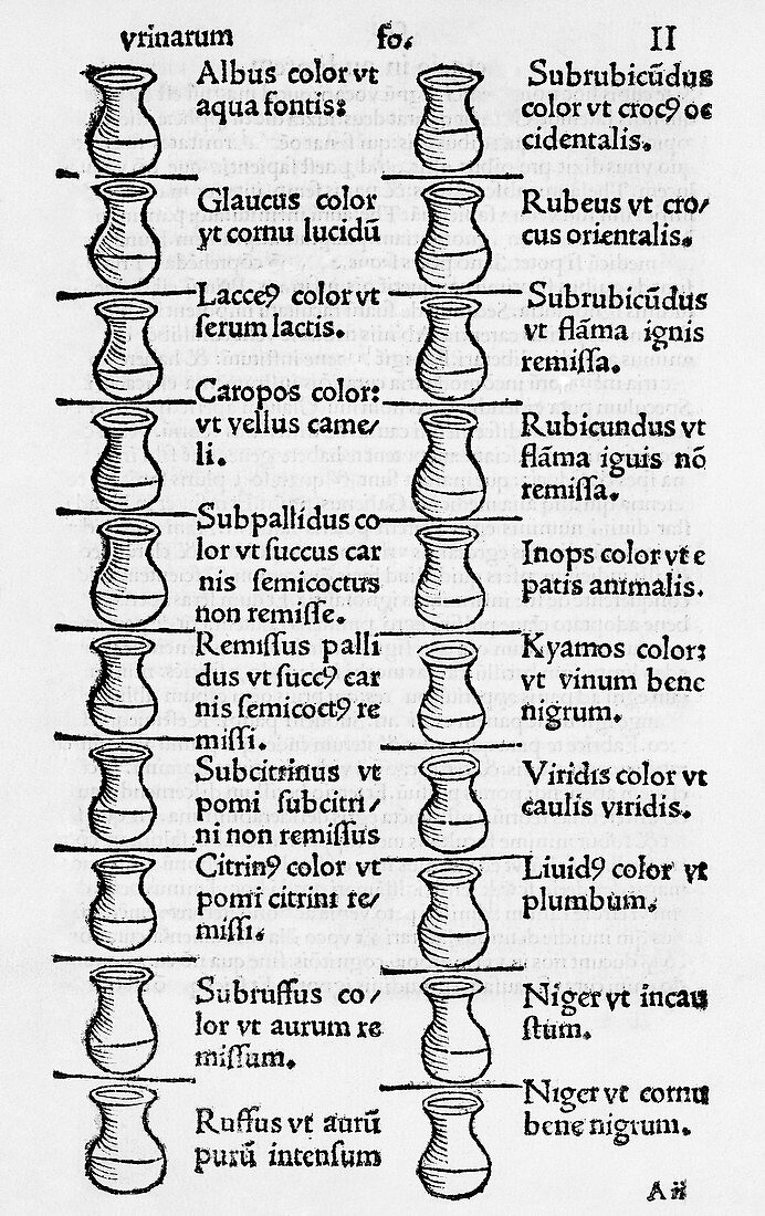 Diagnosis from urine,16th century