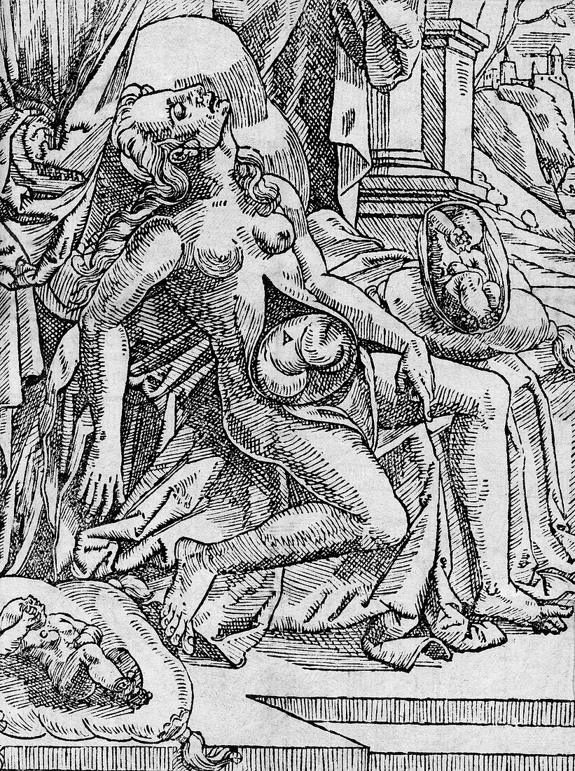 Caesarean birth,17th c. illustration