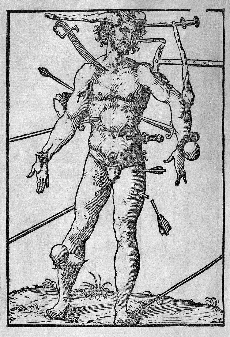 Combat injuries,16th century