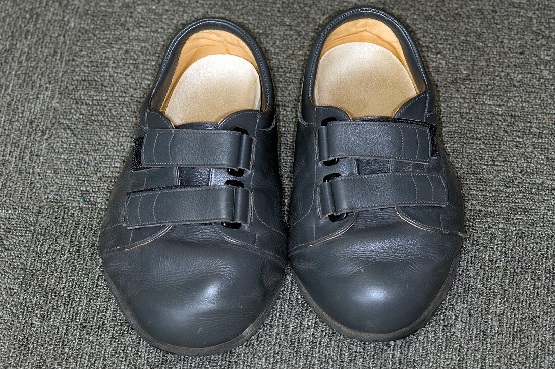 Surgical shoes for arthritic patient