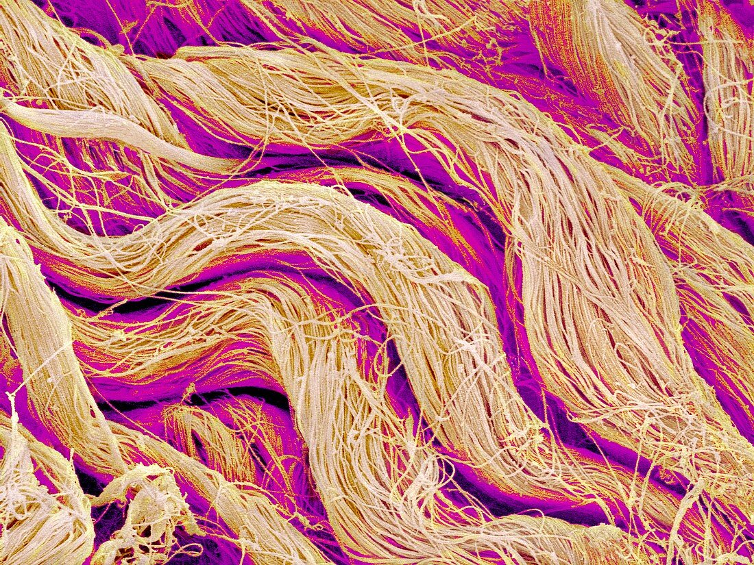 Collagen fibres,SEM