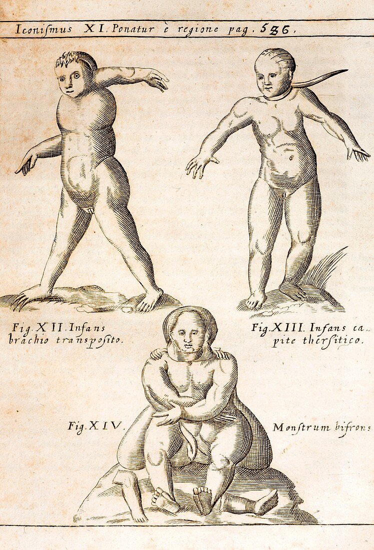 1662 Schott birth defects,teratology