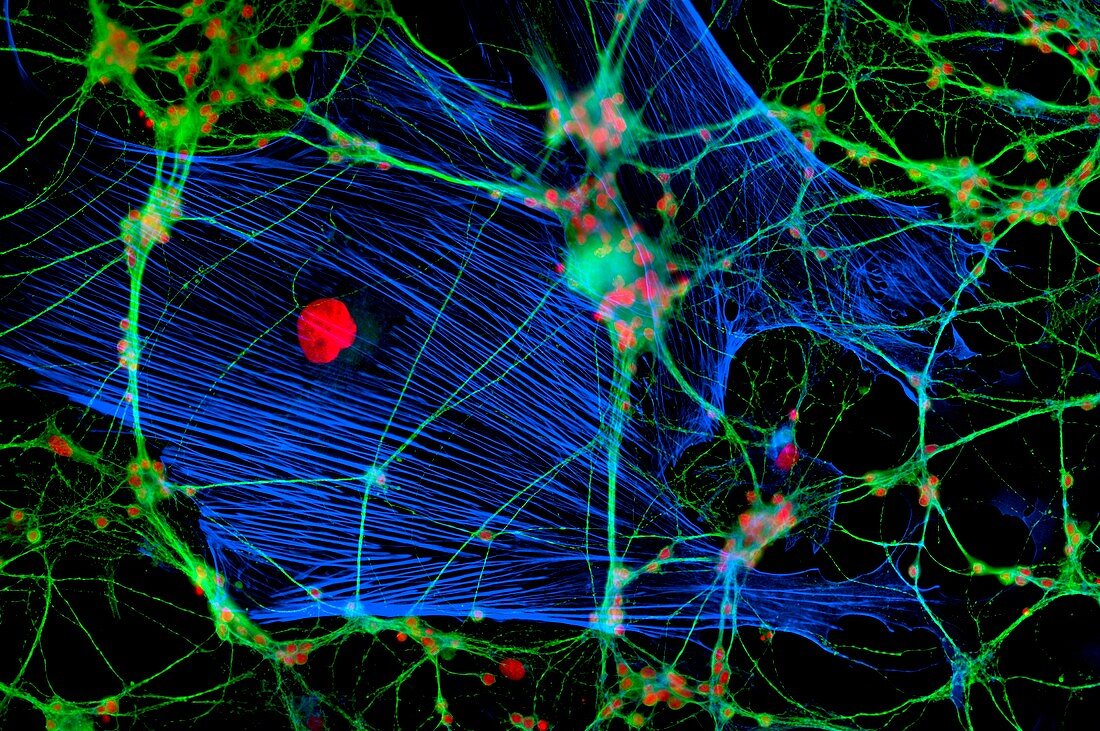 Glial cells,fluorescent micrograph