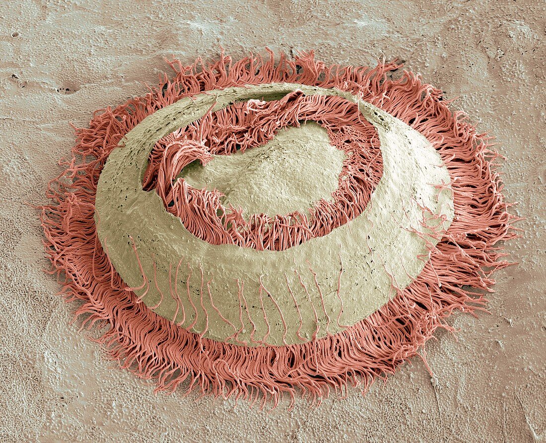 Trichodina parasite,SEM