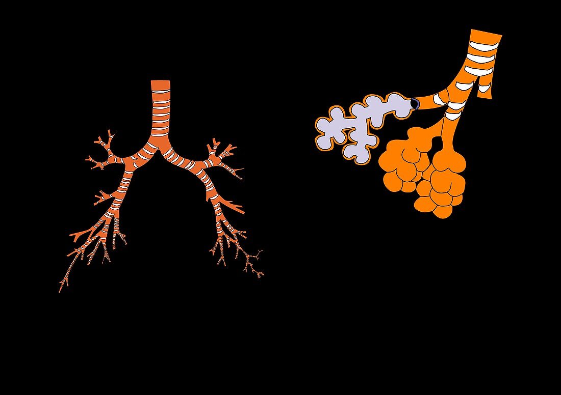 Bronchus and bronchioles,artwork