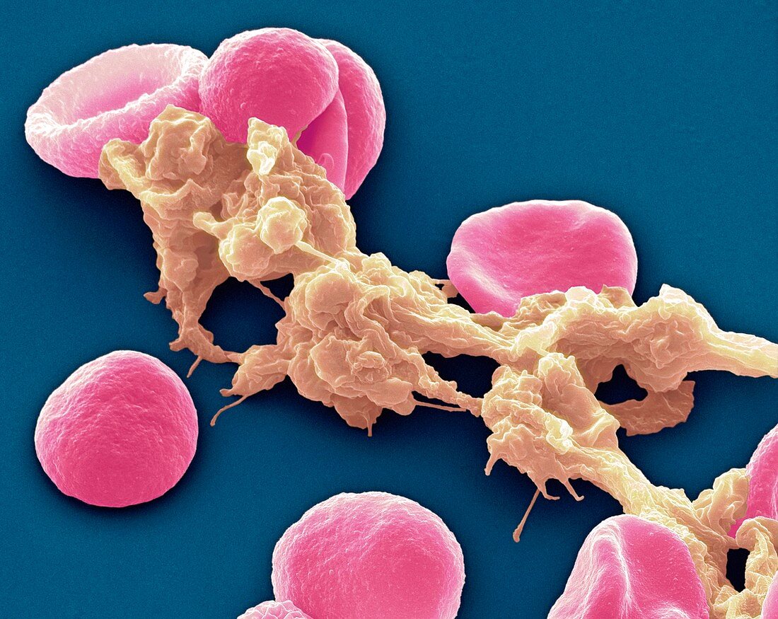 Red blood cells and platelets,SEM