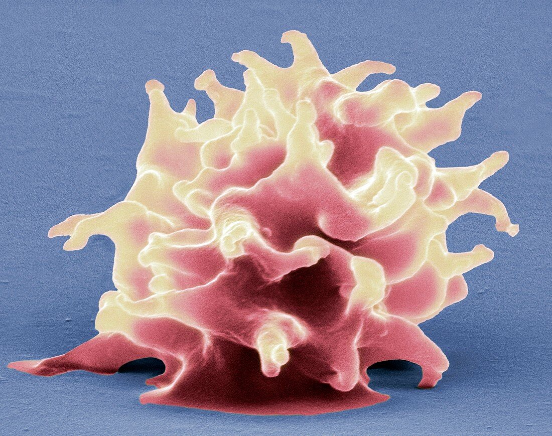 Crenated red blood cell,SEM
