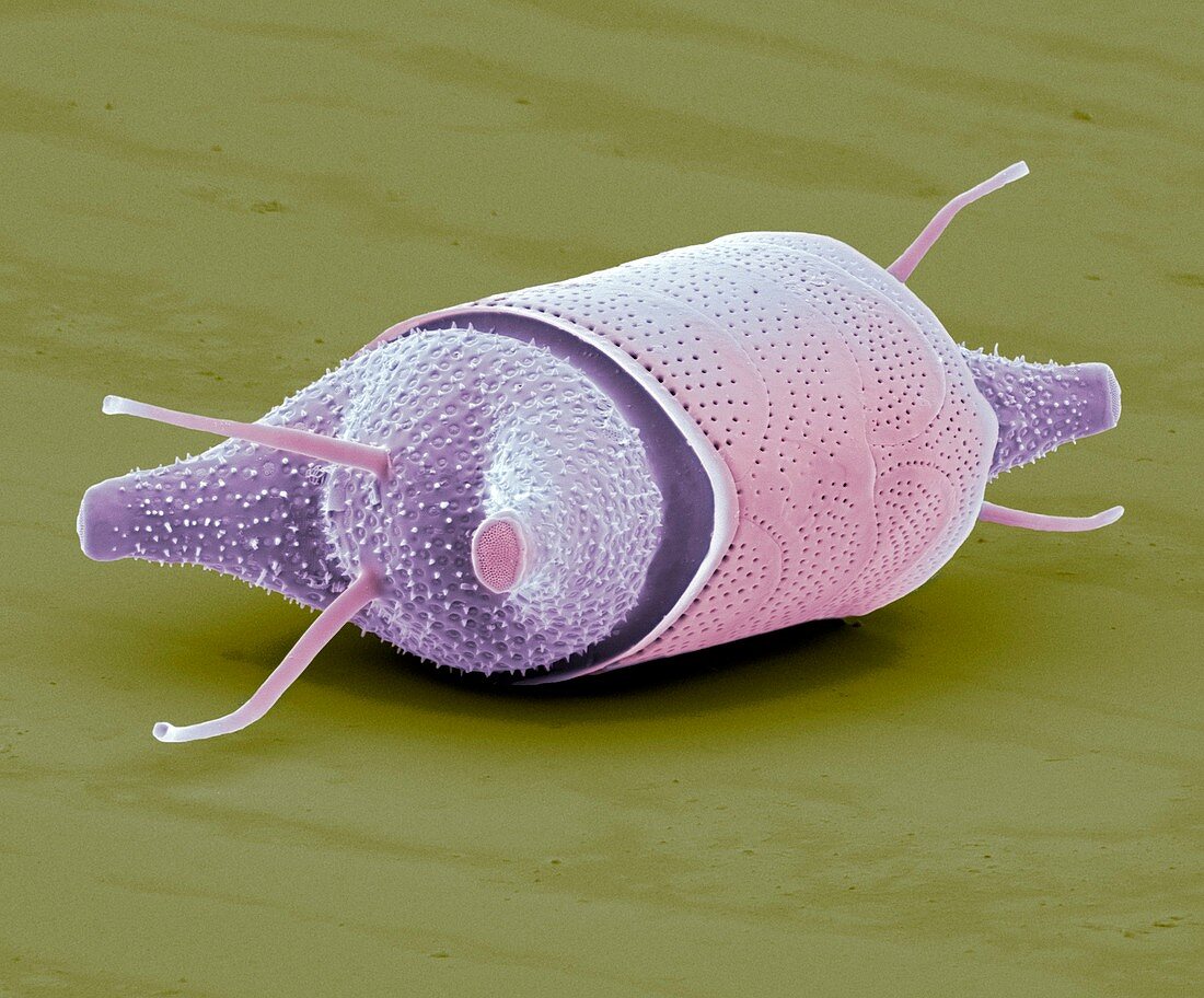 Diatom,SEM