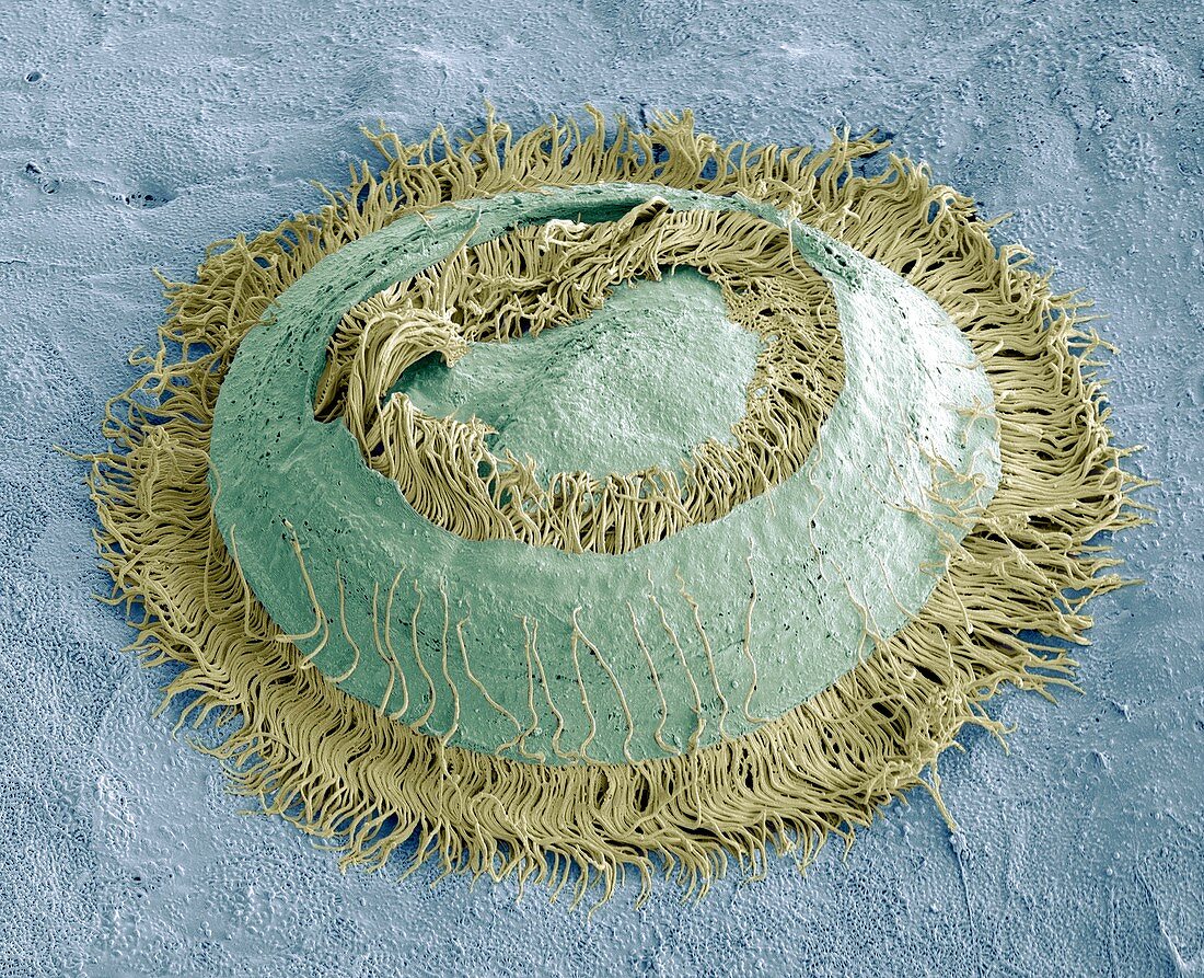 Trichodina parasite,SEM