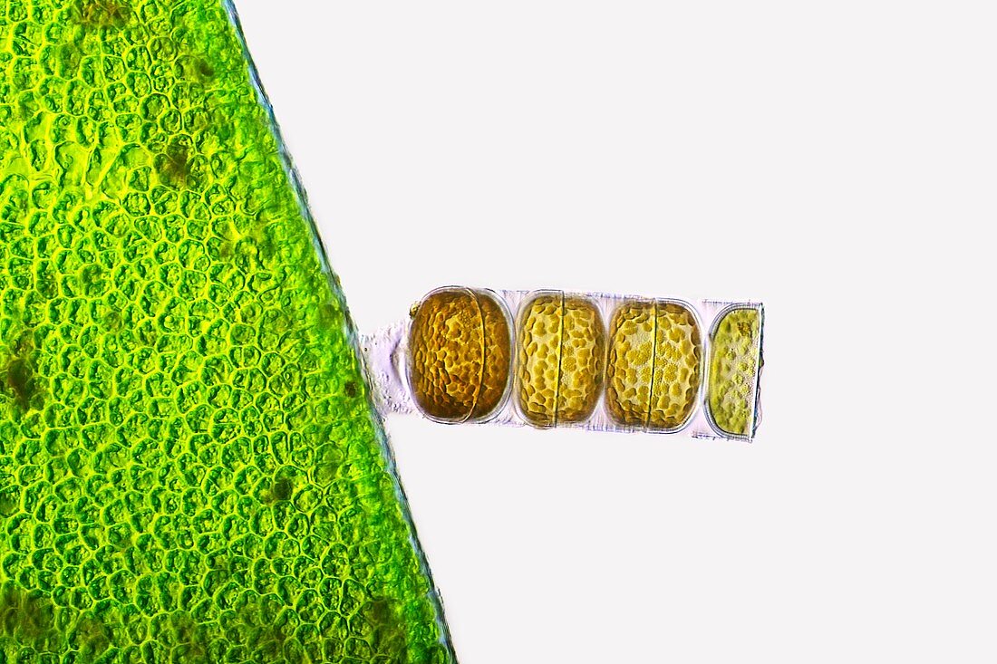 Melosira sp diatoms,light micrograph
