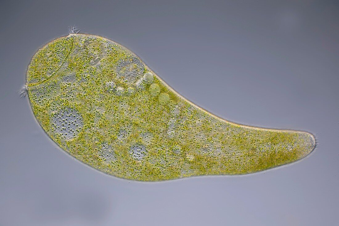 Stentor ciliate protozoan,micrograph