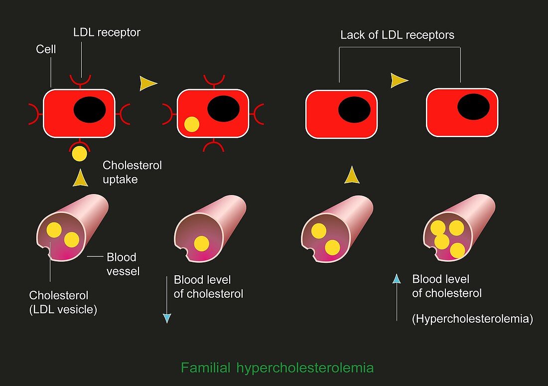 Familial hypercholesterolaemia,diagram