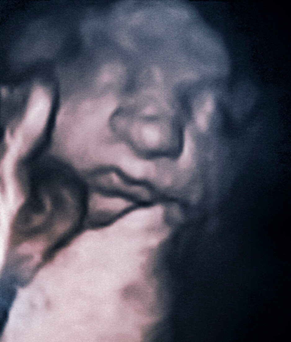 Foetus face at 32 weeks,3D ultrasound