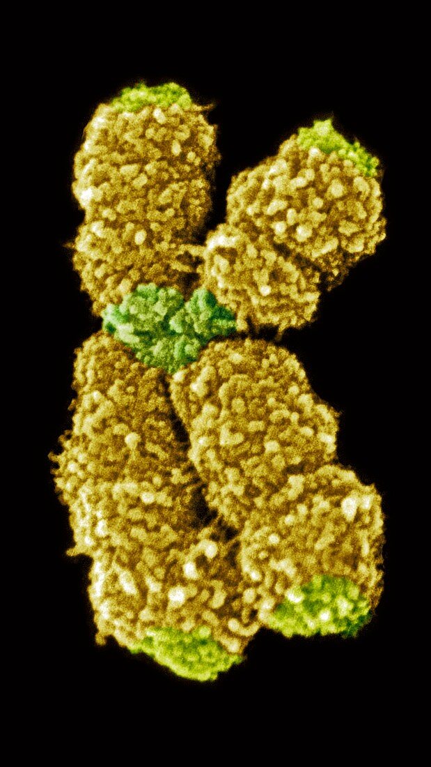 Human chromosome 10,SEM