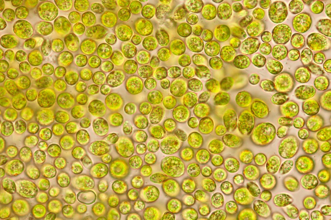 Acidophilic algae,light micrograph