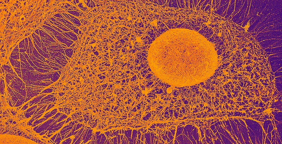 Cytoskeleton,SEM