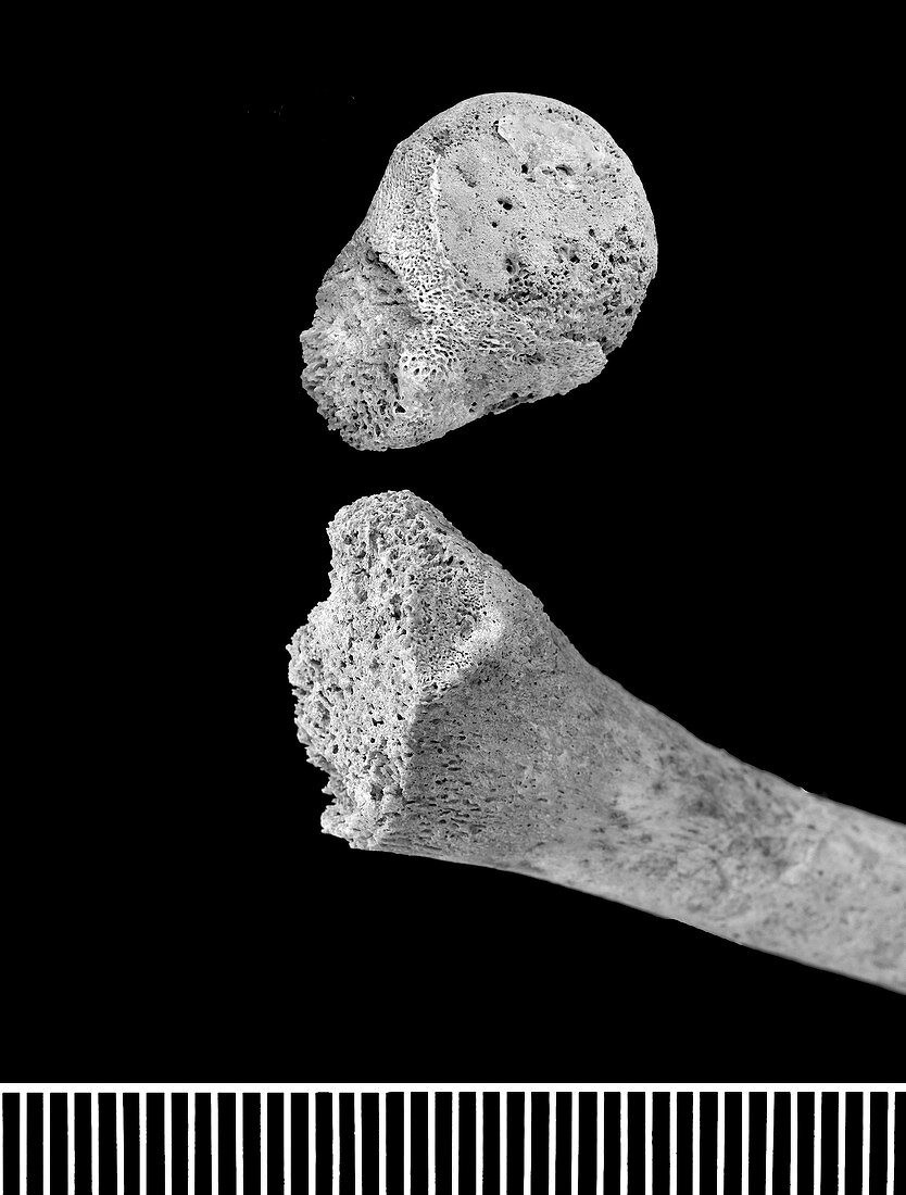 Infant bones from Roman Britain