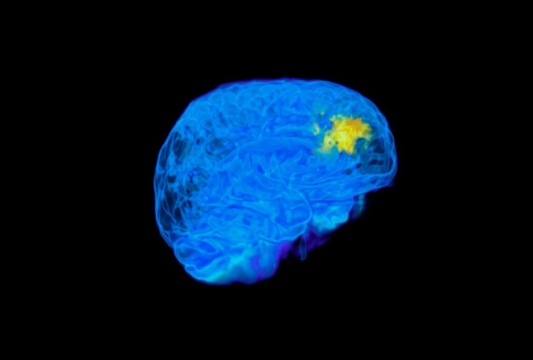 Child's brain activity,MRI scan