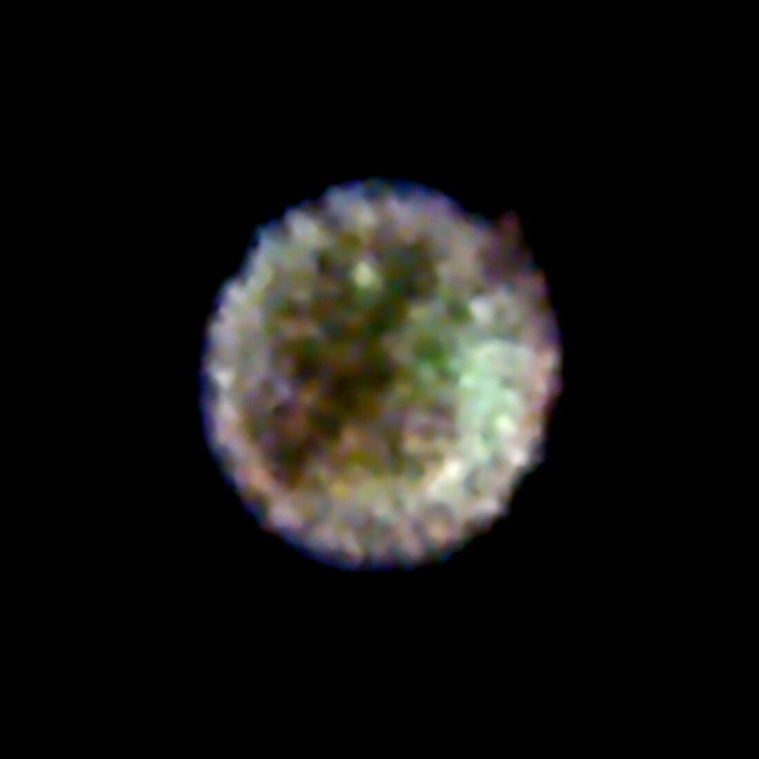 Supernova remnant,X-ray image