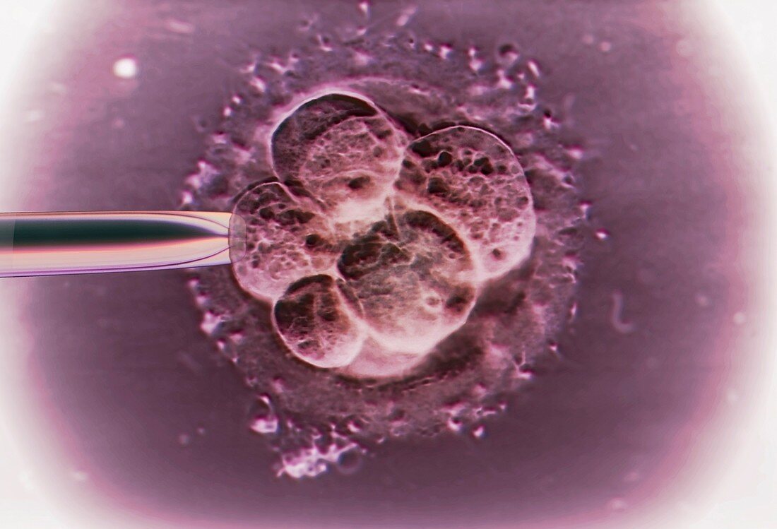 IVF embryo,light micrograph