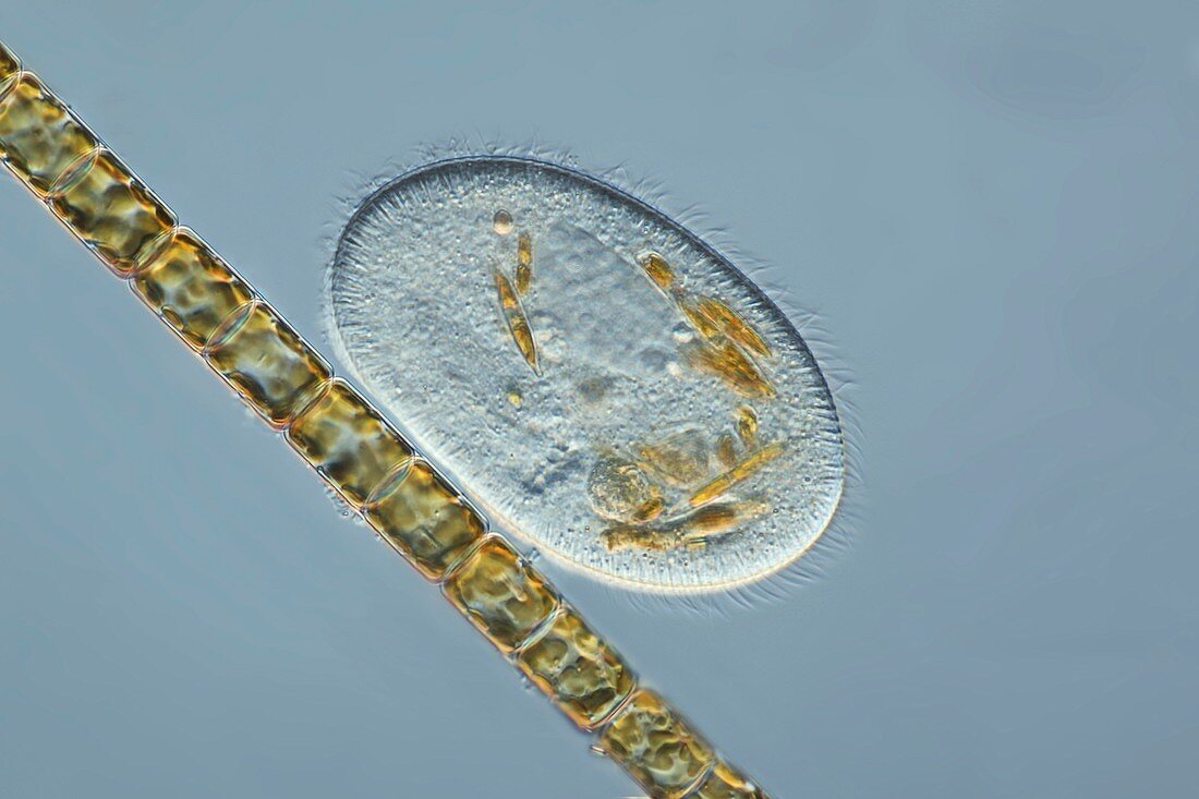 Frontonia protozoan,light micrograph