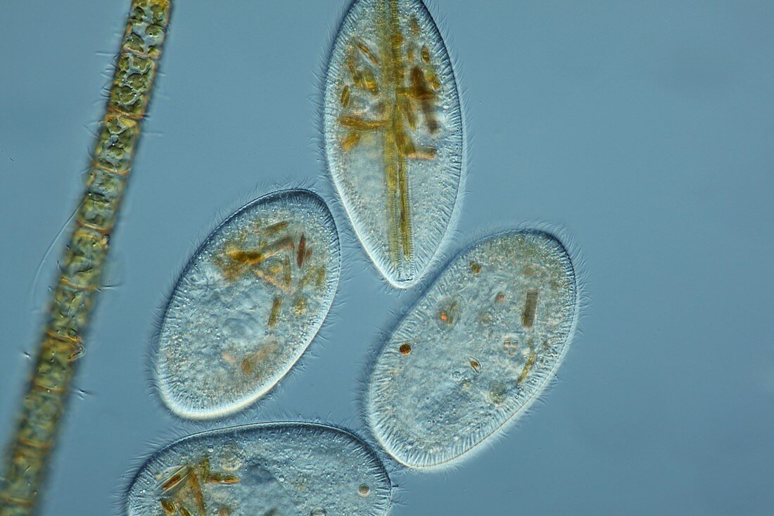 Frontonia protozoa,light micrograph