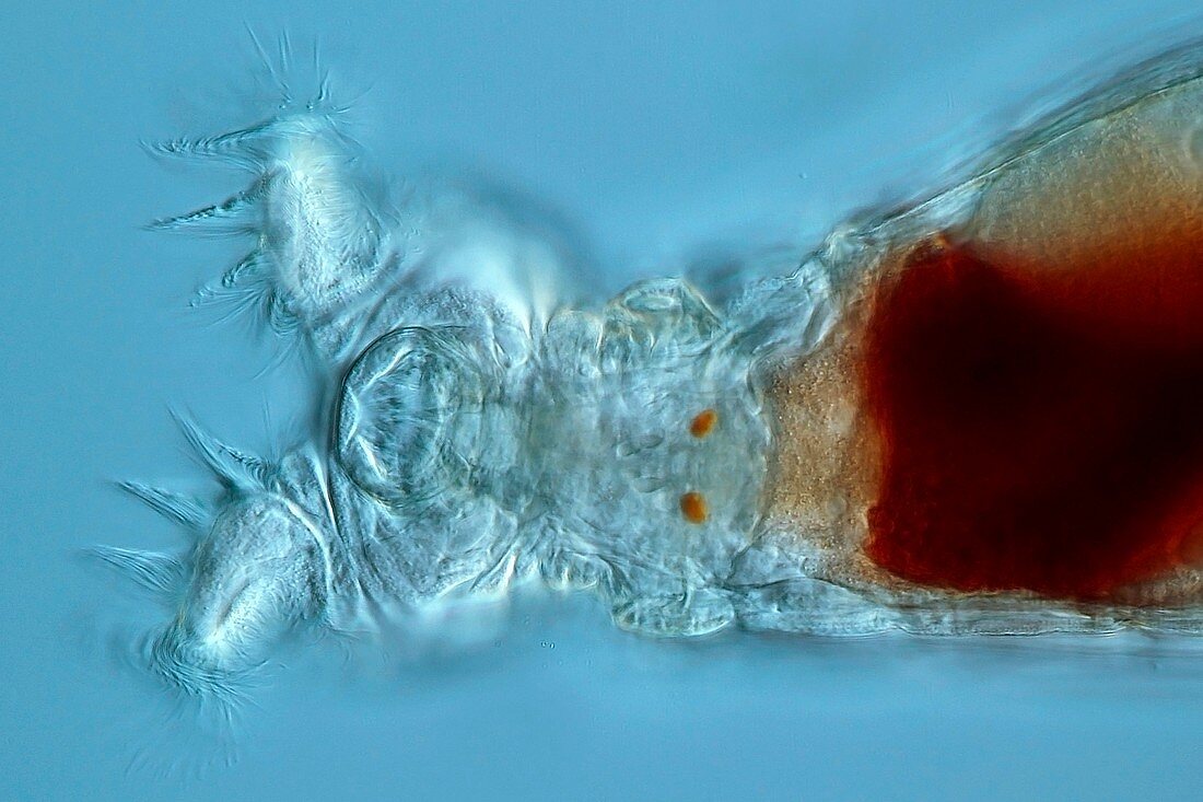 Philodina rotifer,light micrograph