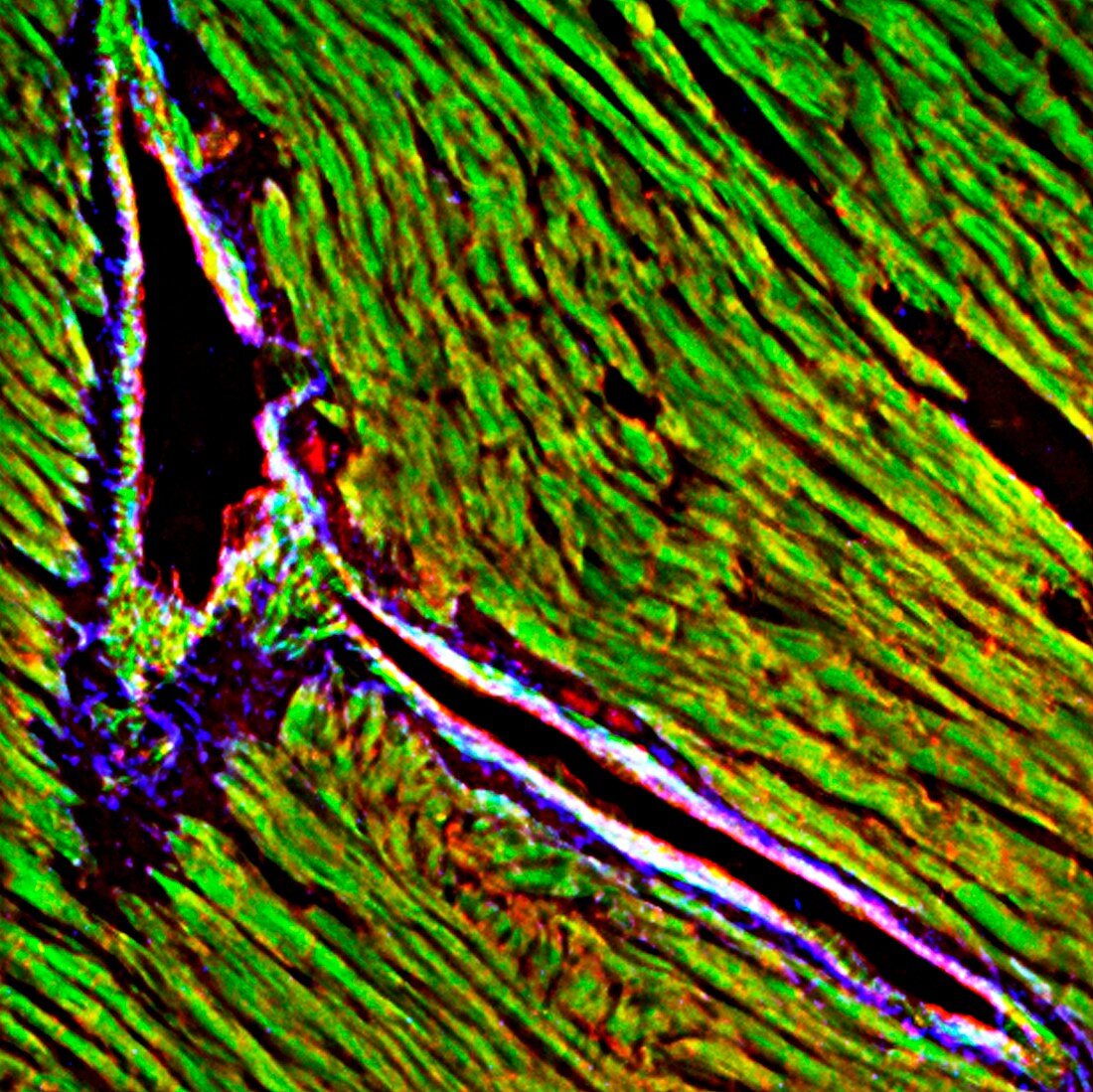 Heart tissue,fluorescence micrograph
