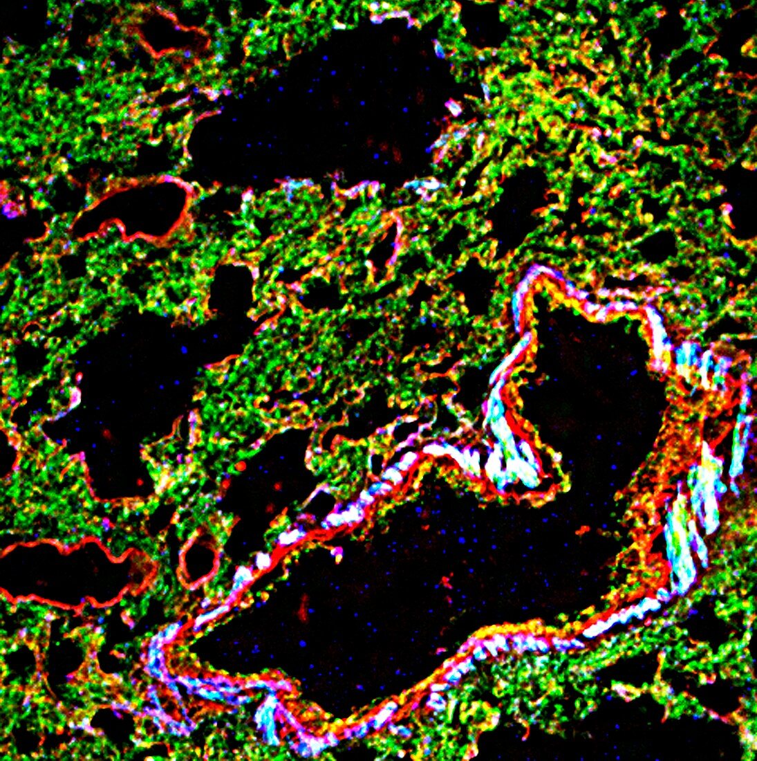 Lung tissue,fluorescence micrograph