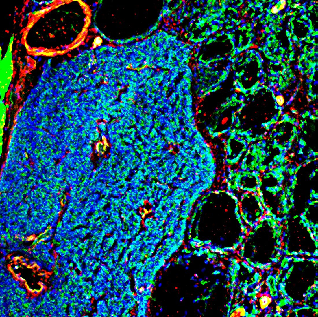 Throat tissue,fluorescence micrograph