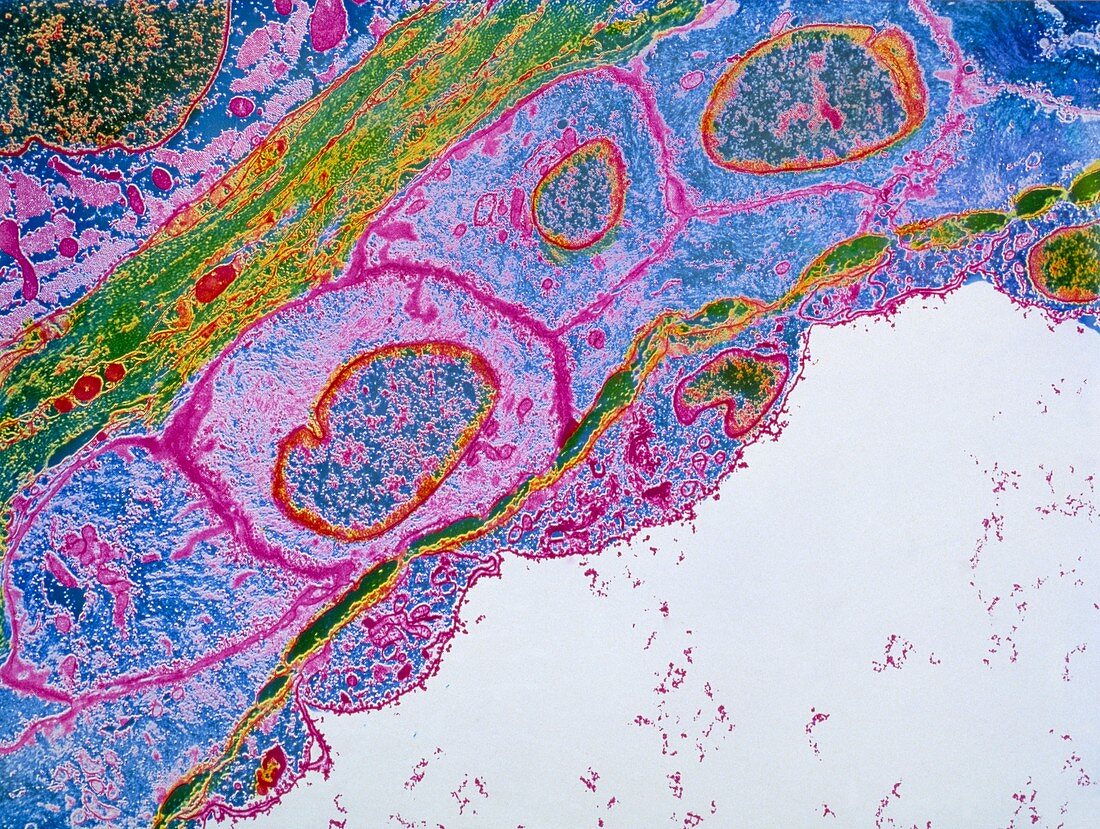 Heart blood vessel wall,TEM
