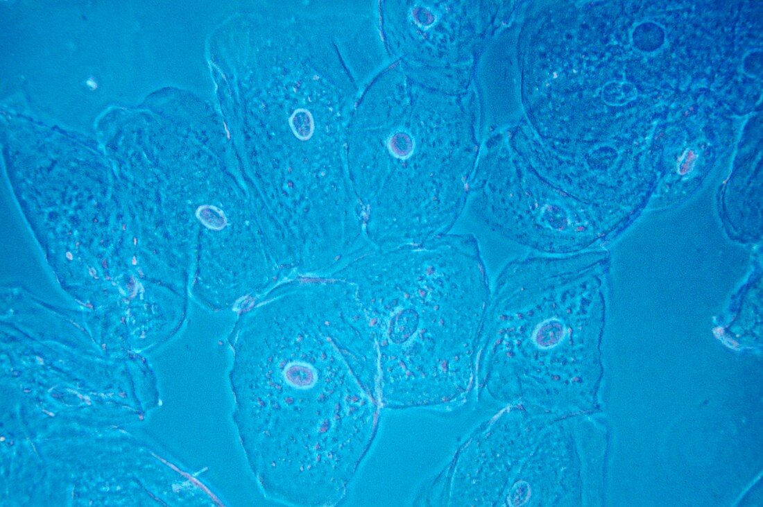 Mouth epithelial cells,light micrograph
