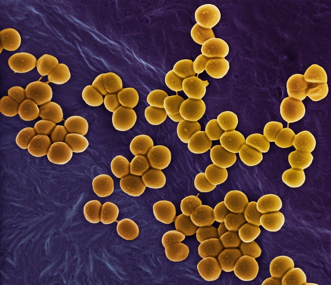MRSA bacteria,SEM