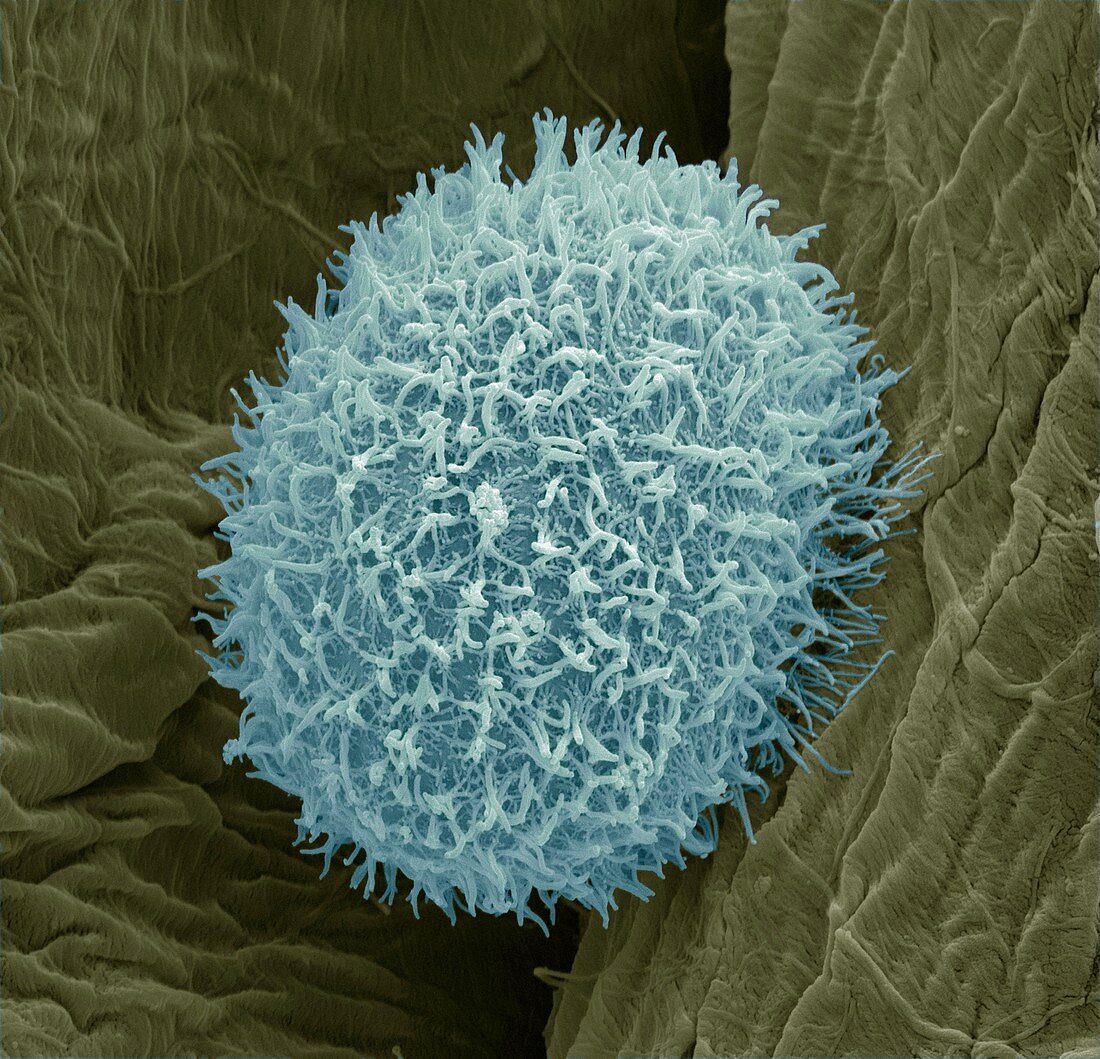 Ciliate protozoan,SEM