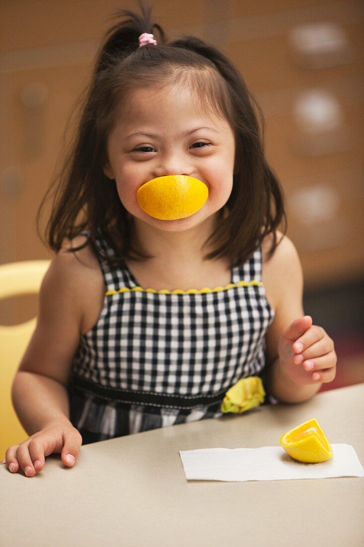 A little girl with Down Syndrome eating an orange