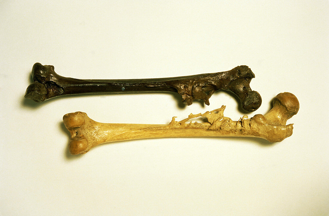 Comparison of diseased femur of Java & modern man