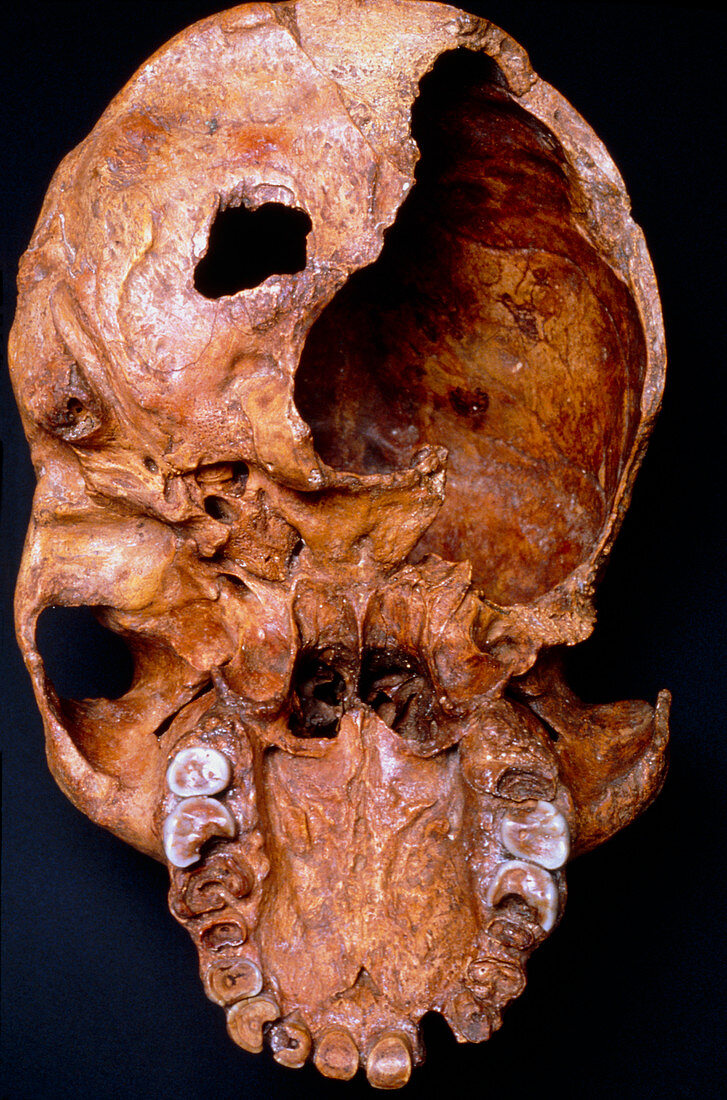 Fossil skull of Rhodesia man