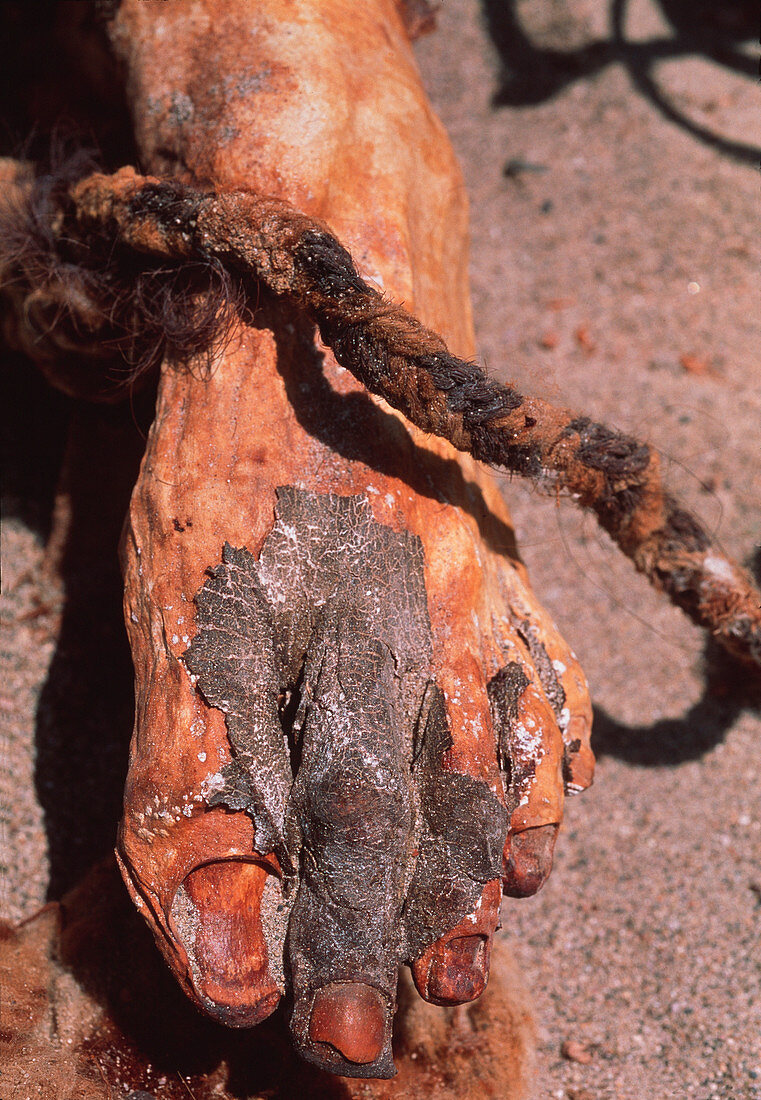 Mummified foot