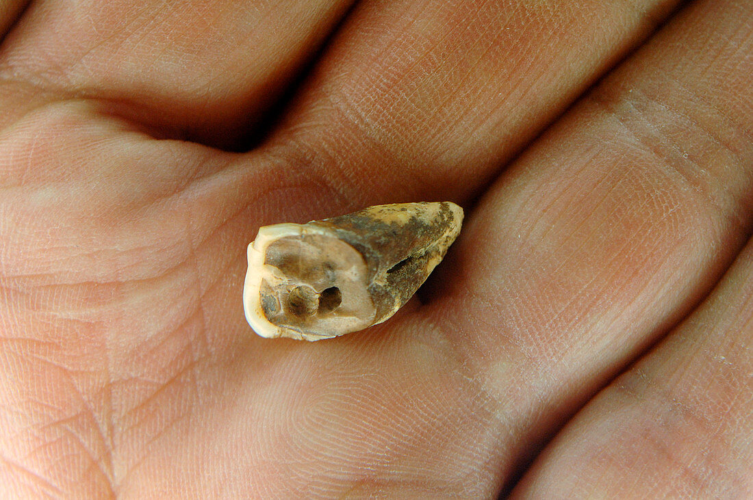 Neolithic dentistry research
