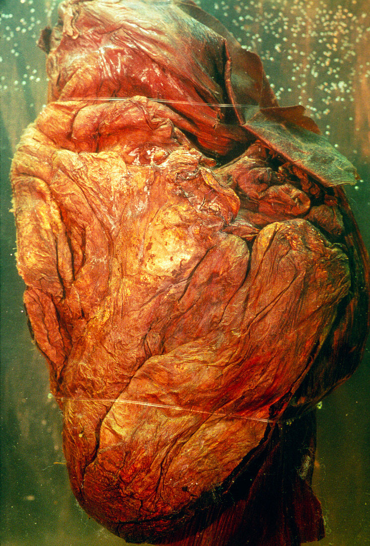 Preserved heart of the baby woolly mammoth,Dima
