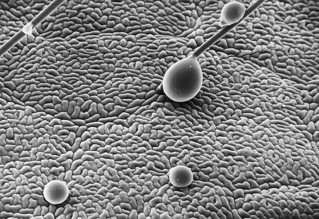 SEM of pesticide droplets on the surface of a leaf