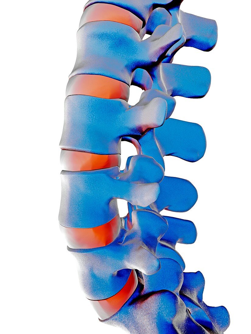 Lumbar spine,computer artwork