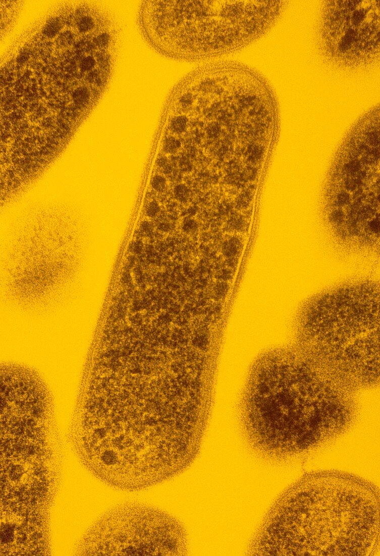TEM of Gardnerella vaginalis bacteria