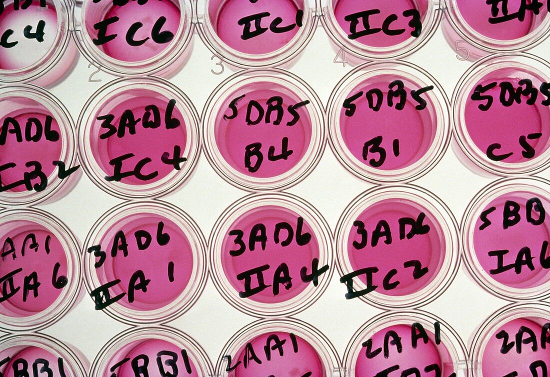 Labelled wells used for tissue cultures