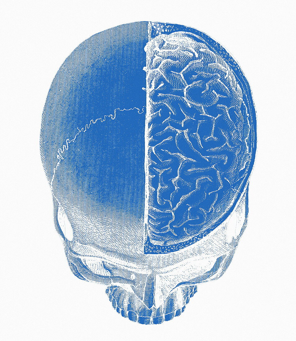 Human skull