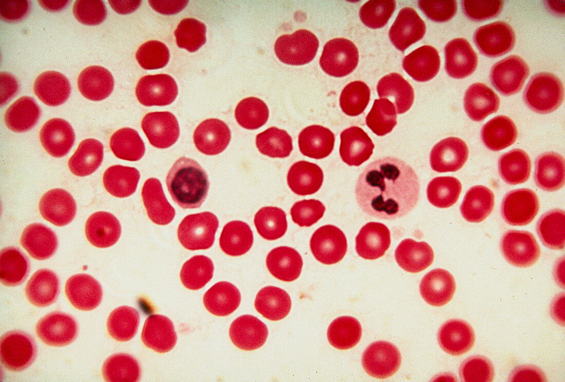 LM showing human red and white blood cells
