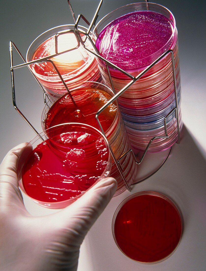 Petri dish bacterial culture being placed in stack
