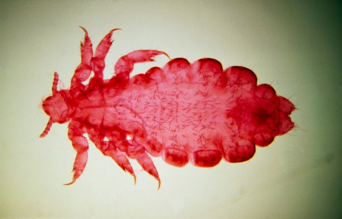 LM of a female human body louse,Pediculus humanis