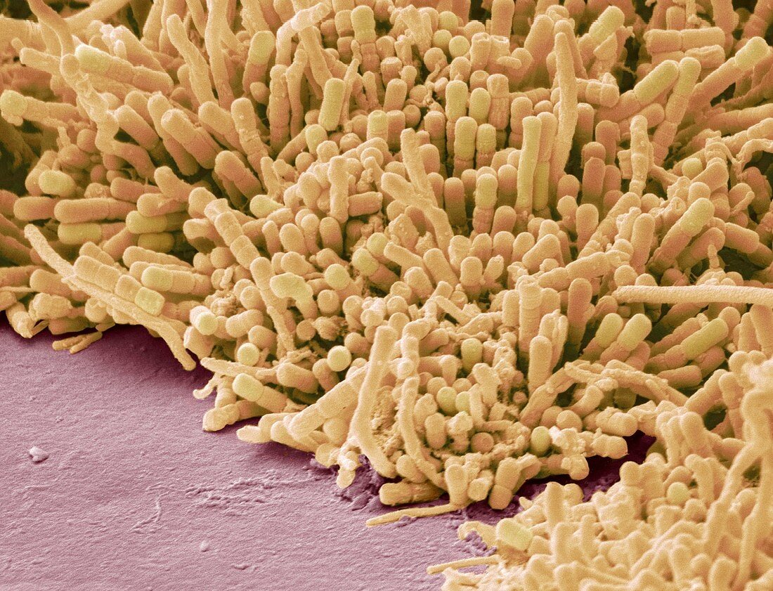 Plaque-forming bacteria,SEM