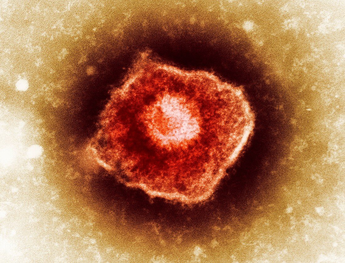 Varicella zoster virus particle,TEM